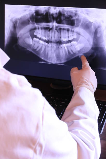 Best Emergency Wisdom Teeth Removal in South Ack, NY